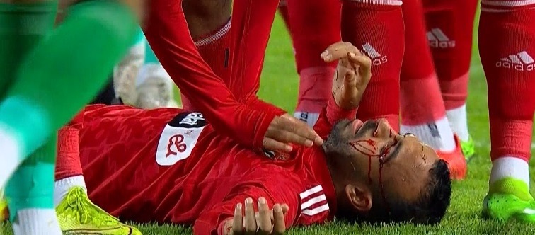 تفاصيل عملية الاحتيال التي تعرض لها محمد مجدي أفشة